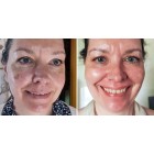 before-after-heike-hackmann