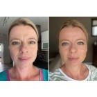 before-after-kathrin-foremny