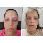 before-after-petra-vesel