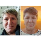 before-after-romana-mocnik