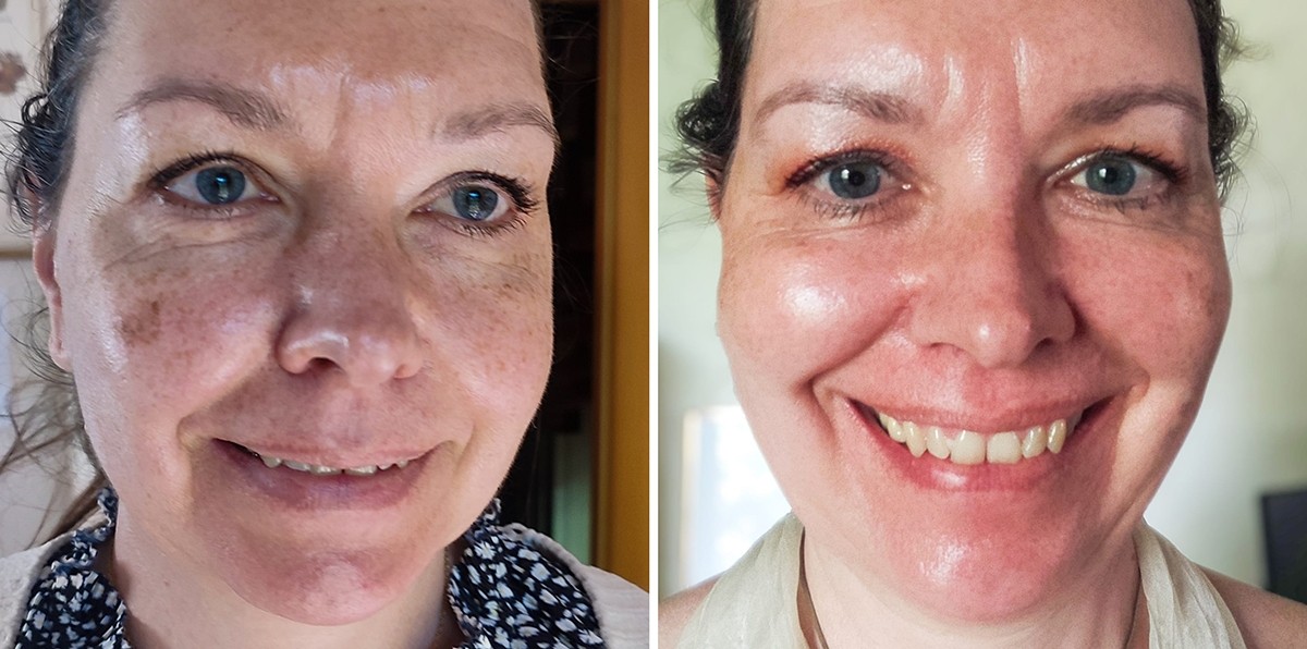 before-after-heike-hackmann