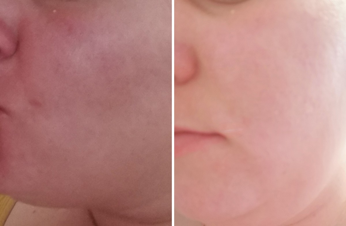 before-after-mateja-lapuh