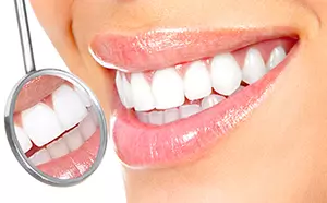 8 napak, ki jih delamo vsi ko gre za skrb naših zob