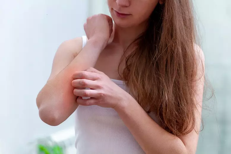Kako ravnati ob piku ose ali čebele
