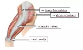 4 najpogostejše poškodbe pri teku